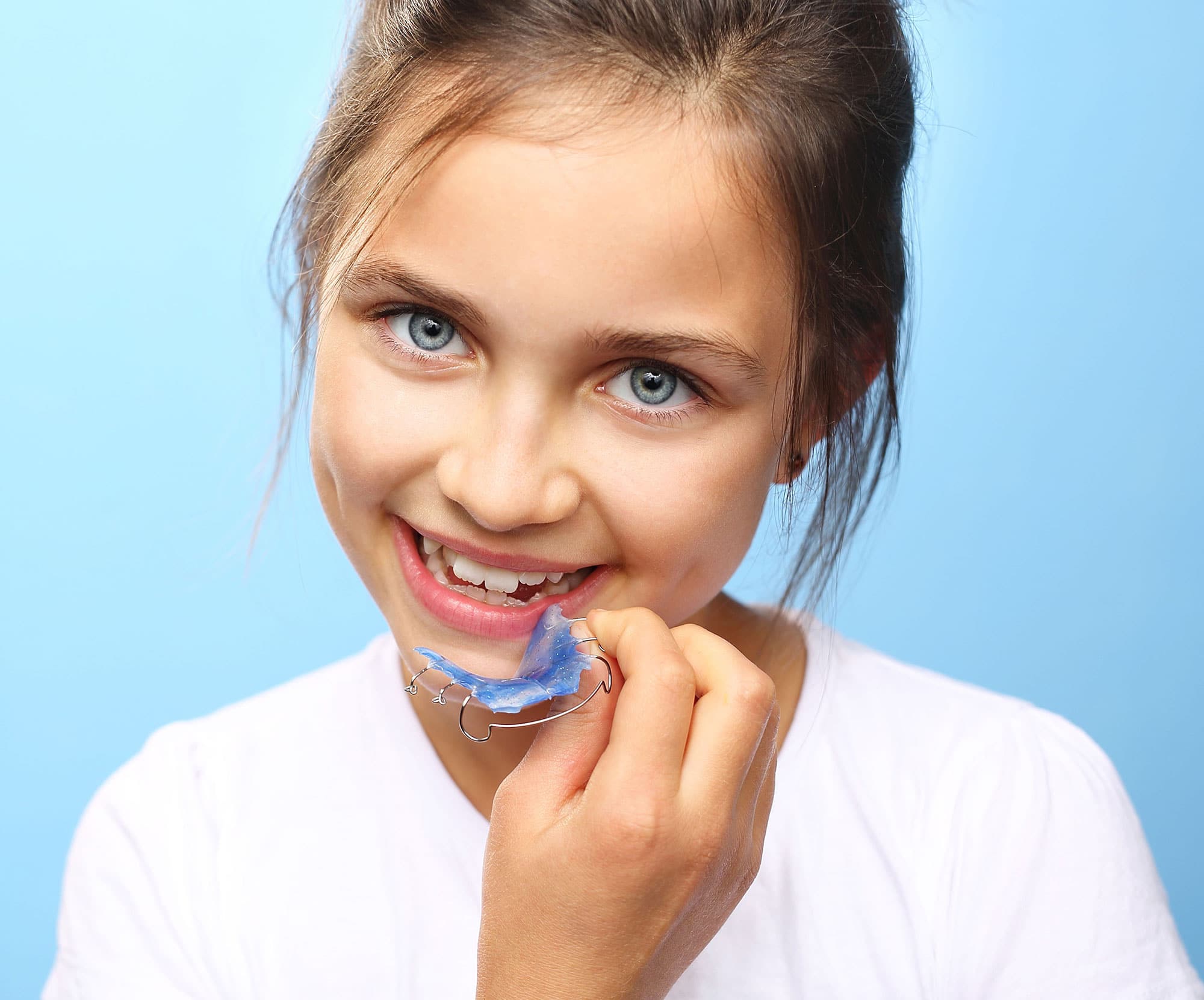 Вопросы детской стоматологии: Неровные зубы у детей – что делать?