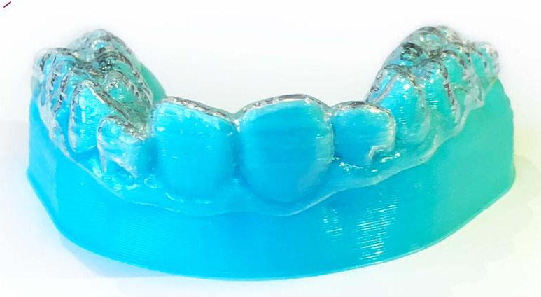 прозрачные капы элайнеров